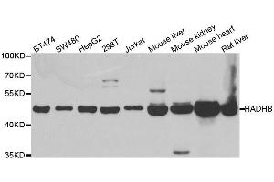 Western blot analysis of extracts of various cell lines, using HADHB antibody. (HADHB antibody  (AA 34-270))