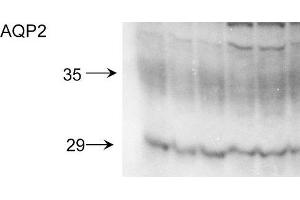 Western blot analysis of Rat kidney inner medullary homogenates showing detection of Aquaporin 2 protein using Rabbit Anti-Aquaporin 2 Polyclonal Antibody .