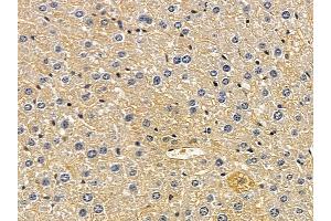ABIN6258498 and ABIN6274470 at 1/100 staining mouse liver tissue by IHC-P.
