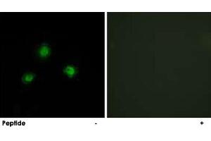 Immunofluorescence analysis of A-549 cells, using UBN1 polyclonal antibody . (Ubinuclein 1 antibody)