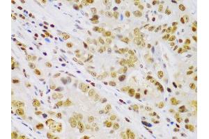 Immunohistochemistry (IHC) image for anti-Inhibitor of kappa Light Polypeptide Gene Enhancer in B-Cells, Kinase beta (IKBKB) (AA 630-730) antibody (ABIN3022876)