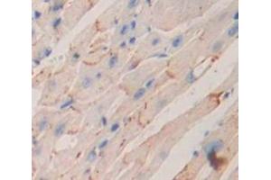 Figure. (IL12RB2 antibody  (AA 455-606))