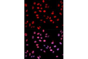 Immunofluorescence analysis of U2OS cell using Phospho-c-Jun-S243 antibody. (C-JUN antibody  (pSer243))