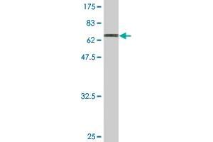 Western Blot detection against Immunogen (70. (Trnt1 antibody  (AA 1-405))