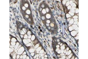 ABIN6268678 at 1/100 staining human colon tissues sections by IHC-P. (GJB1 antibody  (Internal Region))