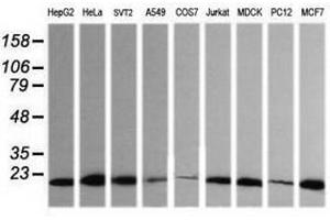 Image no. 2 for anti-HRas proto-oncogene, GTPase (HRAS) antibody (ABIN1498714) (HRAS antibody)