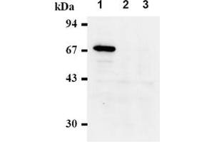 Western Blotting (WB) image for anti-Checkpoint Kinase 2 (CHEK2) antibody (ABIN487488) (CHEK2 antibody)