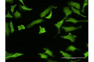 Immunofluorescence of monoclonal antibody to ZNF287 on HeLa cell. (ZNF287 antibody  (AA 231-330))
