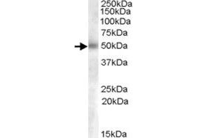 GCNT3 polyclonal antibody  (0. (GCNT3 antibody  (AA 273-284))