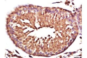 Paraformaldehyde-fixed, paraffin embedded rat testis, Antigen retrieval by boiling in sodium citrate buffer (pH6. (Vinculin antibody  (AA 1001-1134))