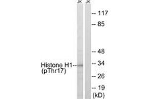 Western blot analysis of extracts from Jurkat cells treated with UV 15', using Histone H1 (Phospho-Thr17) Antibody. (Histone H1 antibody  (pSer17))