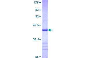 FBXW7 Protein (AA 599-707) (GST tag)