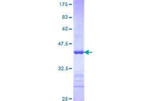 FBXW7 Protein (AA 599-707) (GST tag)