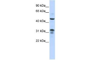 WB Suggested Anti-ZNF765 Antibody Titration:  0.