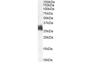 Image no. 1 for anti-FOS-Like Antigen 1 (FOSL1) (Internal Region) antibody (ABIN374695) (FOSL1 antibody  (Internal Region))
