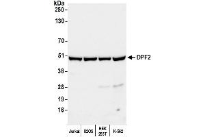 Western Blotting (WB) image for anti-Zinc finger protein ubi-d4 (DPF2) (AA 125-175) antibody (ABIN7451434) (DPF2 antibody  (AA 125-175))