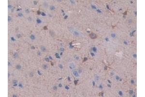 IHC-P analysis of Mouse Cerebrum Tissue, with DAB staining. (SLIT1 antibody  (AA 3-211))