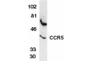 Image no. 2 for anti-Chemokine (C-C Motif) Receptor 5 (CCR5) (AA 6-20) antibody (ABIN208230) (CCR5 antibody  (AA 6-20))