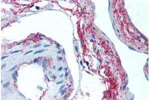 Human Skeletal Muscle, Vessels (formalin-fixed, paraffin-embedded) stained with ELN antibody ABIN305753 at 5 ug/ml followed by biotinylated anti-mouse IgG secondary antibody ABIN481714, alkaline phosphatase-streptavidin and chromogen. (Elastin antibody)