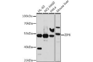Western blot analysis of extracts of various cell lines, using ZIP8 antibody (ABIN6131079, ABIN6147995, ABIN6147996 and ABIN6214638) at 1:1000 dilution. (SLC39A8 antibody  (AA 180-300))