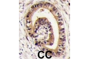 Immunohistochemistry (IHC) image for anti-Golgi-Associated PDZ and Coiled-Coil Motif Containing (GOPC) antibody (ABIN3003089) (GOPC antibody)