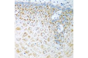 Immunohistochemistry of paraffin-embedded human esophagus using FDXR antibody (ABIN5972045) at dilution of 1/100 (40x lens). (Ferredoxin Reductase antibody)