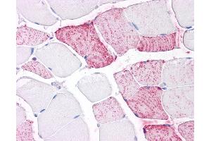 Anti-PTPRA antibody IHC of human skeletal muscle. (PTPRA antibody  (Extracellular Domain))