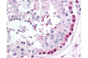 Anti-PINK1 antibody IHC of human testis. (PINK1 antibody  (AA 484-504))