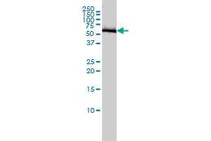 COASY monoclonal antibody (M01), clone 1H6 Western Blot analysis of COASY expression in A-431 . (COASY antibody  (AA 1-225))