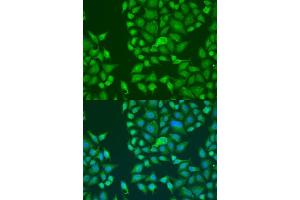 Immunofluorescence analysis of U2OS cells using ST antibody  at dilution of 1:100. (Double-stranded RNA-binding protein Staufen homolog 2 (STAU2) (AA 300-400) antibody)