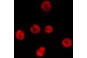 ABIN6277190 staining HepG2 by IF/ICC. (USP7 antibody  (Internal Region))