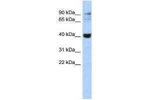 WB Suggested Anti-MMP3 Antibody Titration:  0.