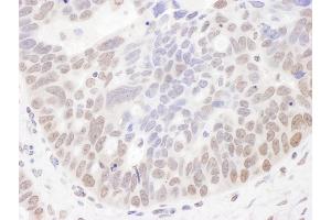 anti-Nucleolar Complex Associated 2 Homolog (NOC2L) (AA 699-749) antibody