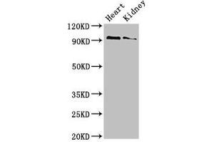 Western Blot Positive WB detected in: Mouse heart tissue, Mouse kidney tissue All lanes: VPS39 antibody at 3 μg/mL Secondary Goat polyclonal to rabbit IgG at 1/50000 dilution Predicted band size: 102, 101 kDa Observed band size: 102 kDa (VPS39 antibody  (AA 263-490))