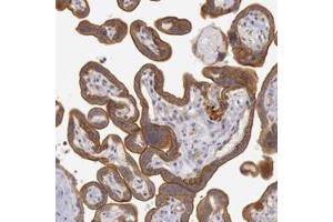 Immunohistochemistry (Formalin/PFA-fixed paraffin-embedded sections) of human placenta with AMOTL1 polyclonal antibody  shows strong cytoplasmic and membranous positivity in trophoblastic cells. (AMOTL1 antibody)