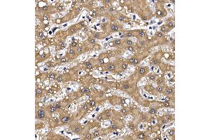 Immunohistochemistry of paraffin-embedded human liver using GFR Rabbit pAb (ABIN6127950, ABIN6141065, ABIN6141066 and ABIN6221017) at dilution of 1:100 (40x lens). (GFRA1 antibody  (AA 25-280))