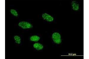 Immunofluorescence of purified MaxPab antibody to FKBP3 on HeLa cell. (FKBP3 antibody  (AA 1-224))