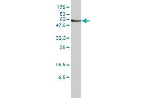 ORC2L monoclonal antibody (M01), clone 3E11-1G5 Western Blot analysis of ORC2L expression in Jurkat . (ORC2 antibody  (AA 1-577))