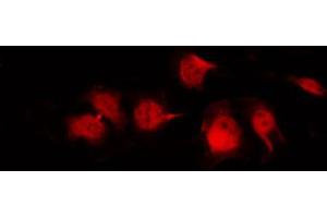 ABIN6269008 staining Hela by IF/ICC. (GLUT1 antibody  (C-Term))