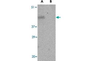 Western blot analysis of PDCD1 in THP-1 cell lysate with PDCD1 polyclonal antibody  at 1 ug/mL in the (A) absence and (B) presence of blocking peptide. (PD-1 antibody  (Internal Region))