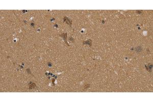 Immunohistochemistry of paraffin-embedded Human brain using PUS10 Polyclonal Antibody at dilution of 1:45 (PUS10 antibody)