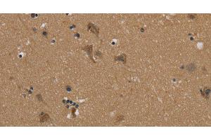 Immunohistochemistry of paraffin-embedded Human brain using PUS10 Polyclonal Antibody at dilution of 1:45