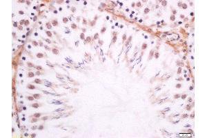 Paraformaldehyde-fixed, paraffin embedded rat testis tissue, Antigen retrieval by boiling in sodium citrate buffer(pH6) for 15min, Block endogenous peroxidase by 3% hydrogen peroxide for 30 minutes, Blocking buffer (normal goat serum) at 37°C for 20min, Antibody incubation with Rabbit Anti-DMO/Dmrt1a Polyclonal Antibody, Unconjugated  at 1:200 overnight at 4°C, followed by a conjugated secondary and DAB staining (DMO/Dmrt1a (AA 51-100) antibody)