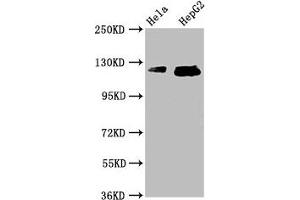 Western Blot Positive WB detected in: Hela whole cell lysate, HepG2 whole cell lysate All lanes: TMF1 antibody at 3.