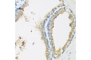 Immunohistochemistry of paraffin-embedded human prostate using WDR77 antibody at dilution of 1:200 (40x lens). (WDR77 antibody)