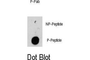 Image no. 1 for anti-Integrin-Linked Kinase (ILK) (pThr173) antibody (ABIN358419)