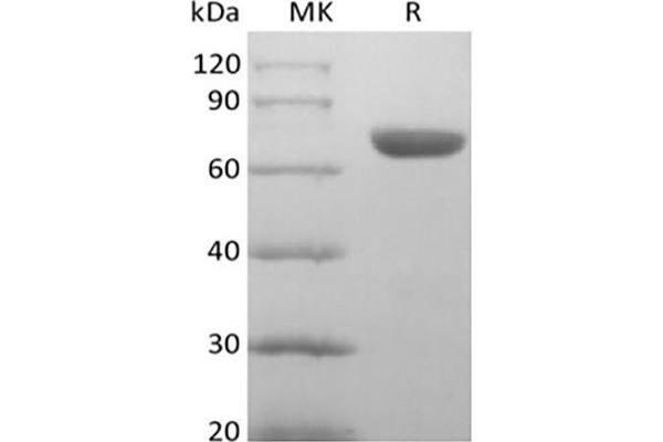 EPH Receptor A8 Protein (EPHA8) (His tag)