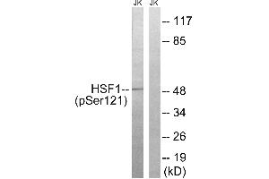 Immunohistochemistry analysis of paraffin-embedded human brain tissue using HSF1 (Phospho-Ser121) antibody. (HSF1 antibody  (pSer121))