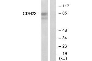 Immunohistochemistry analysis of paraffin-embedded human brain tissue using CDH22 antibody. (CDH22 antibody)