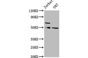 Western Blotting (WB) image for anti-SH3-Domain Binding Protein 5 (SH3BP5) (AA 49-455) antibody (ABIN7169495)